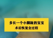 华体会全站-JJJ正式接受脚趾手术三个月后重新评估