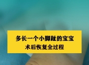 华体会全站-JJJ正式接受脚趾手术三个月后重新评估