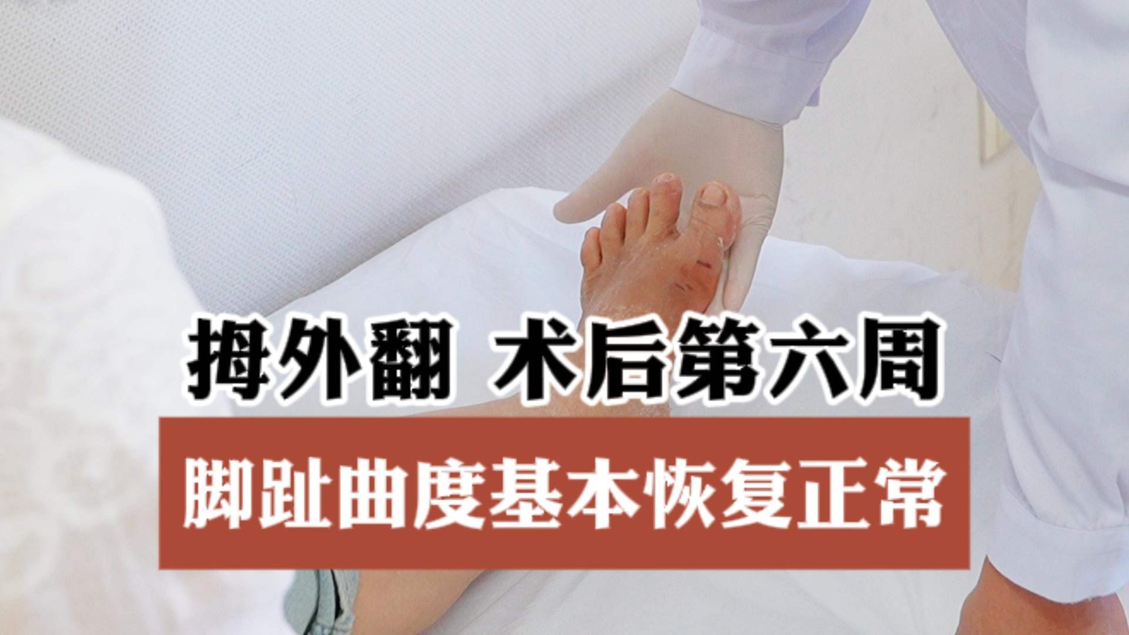 JJJ正式接受脚趾手术三个月后重新评估